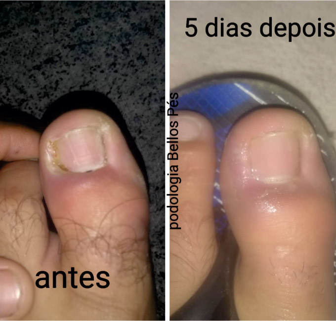 Podologia Saúde dos Pés